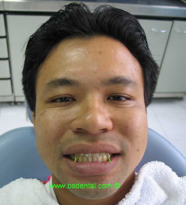 Dentist Malaysia COSMETIC DENTIST and FAMILY DENTIST in Petaling Jaya